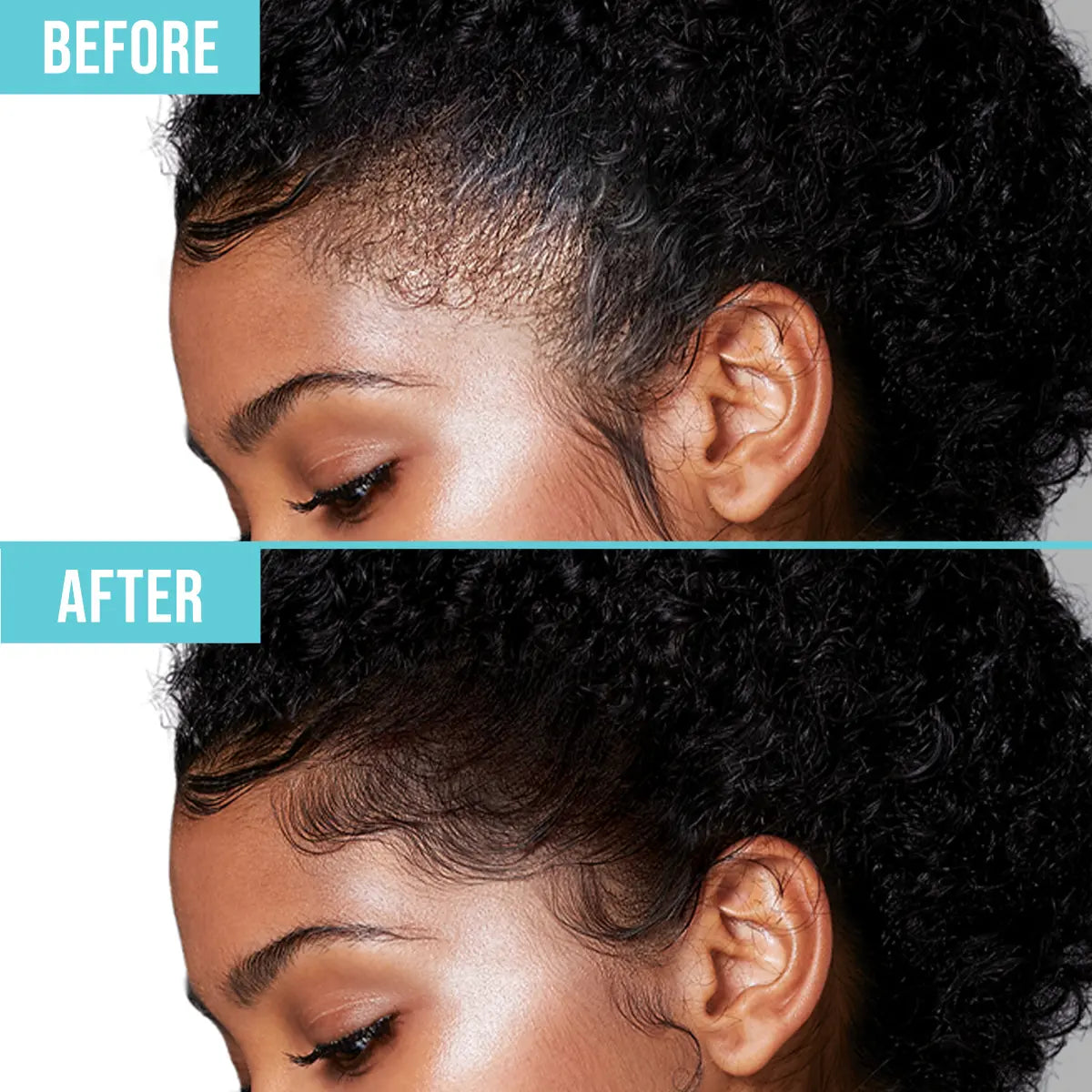 Side-by-side comparison of a woman's hairline showing before and after using an edge fixer; the \