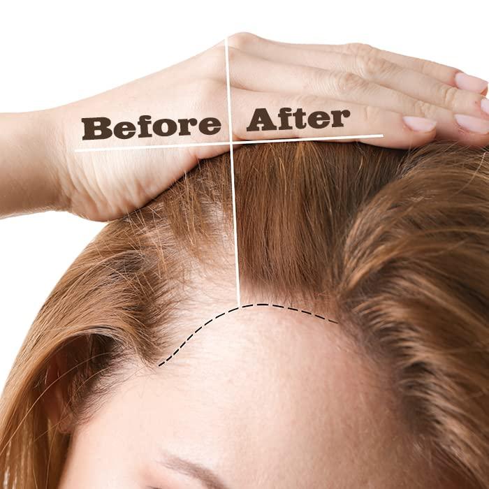 EBIN NEW YORK 100% Natural Hair Growth Oil 4oz/120ml - Lightweight Formula - Buy Online on GoSupps.com