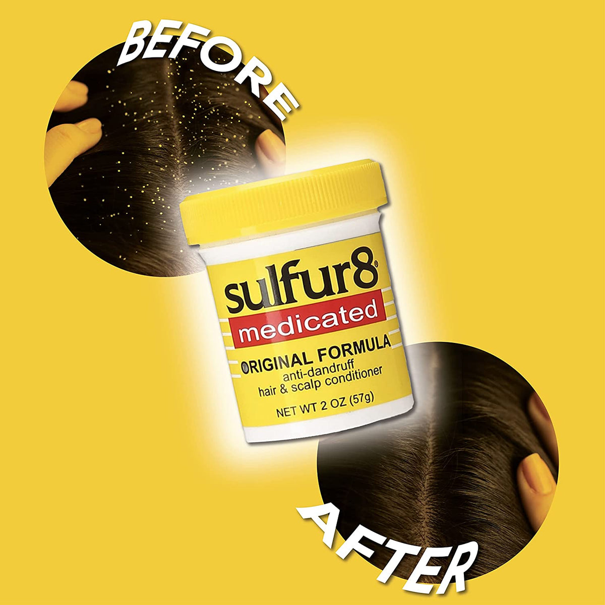 Sulfur-8 Medicated Anti-Dandruff Hair & Scalp Conditioner - Choose Size SULFUR-8