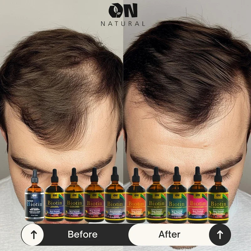 On Naturals Hair and Scalp Batana Oil - 4 oz On Naturals